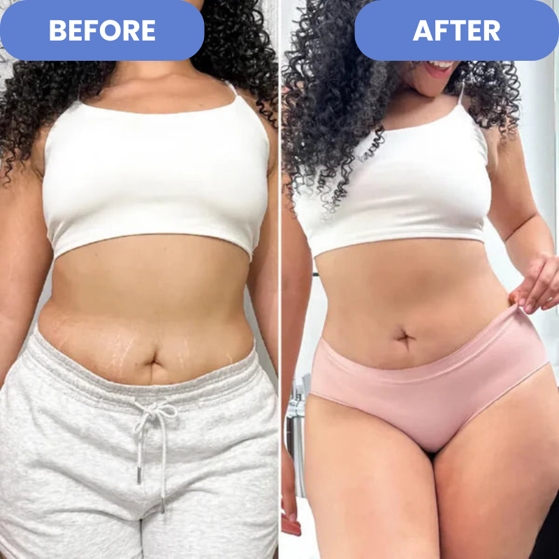 Velina™ - Anti-Cellulite-Entferner | 50 % RABATT