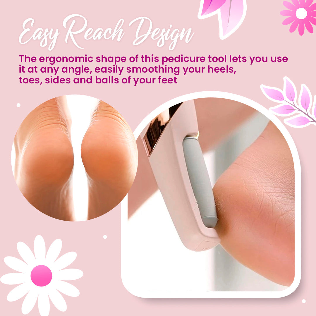 SoftStep™ Elektrischer Hornhautentferner | 1+1 GRATIS