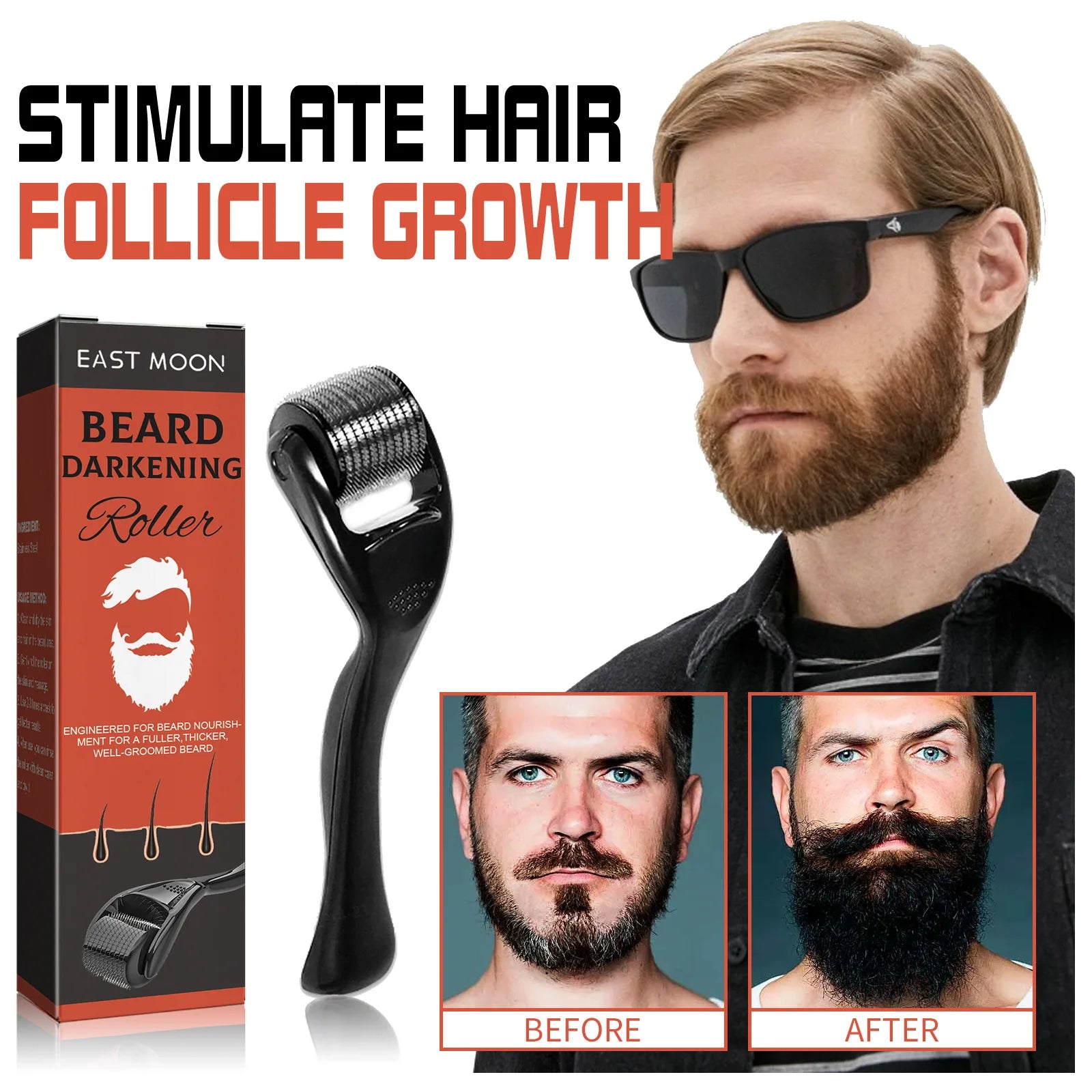 BeardGrow™ Derma Roller