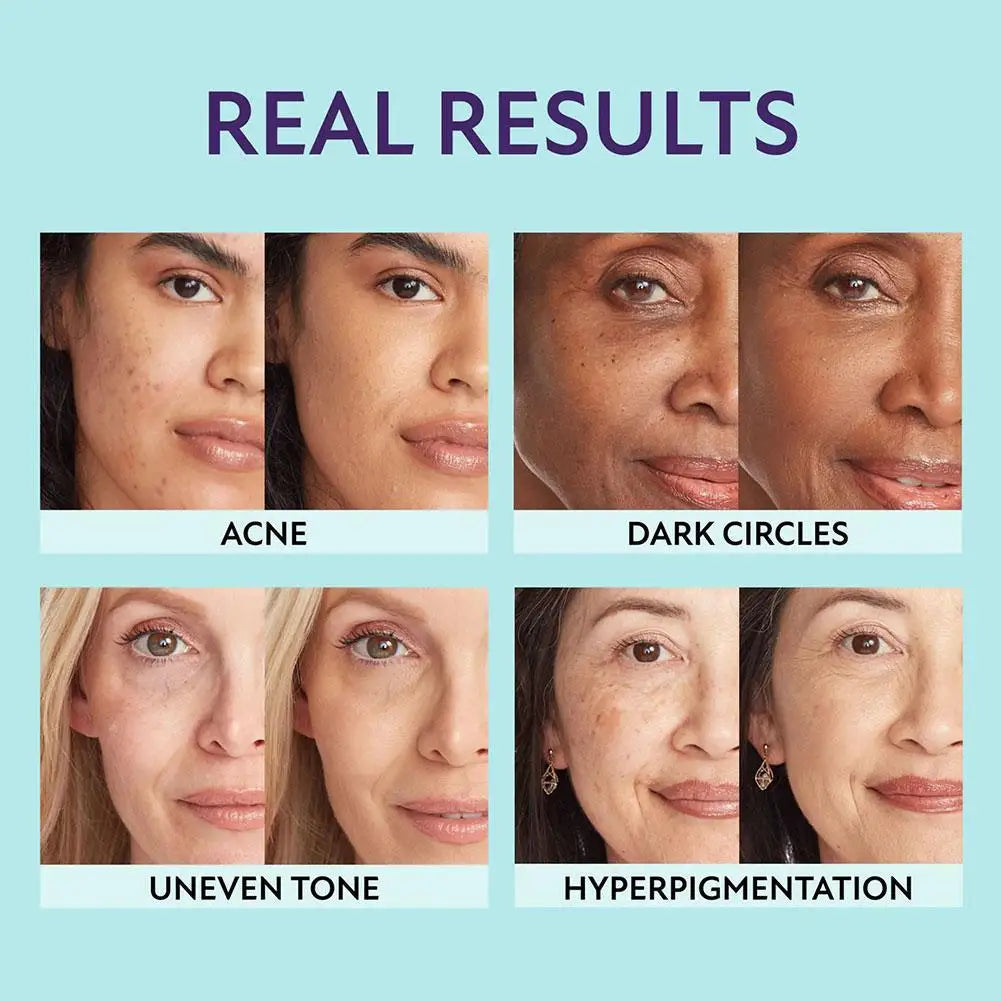 1+1 Gratis | CoverMax Cream™ — Feuchtigkeit spenden, kaschieren und schützen in einem Schritt