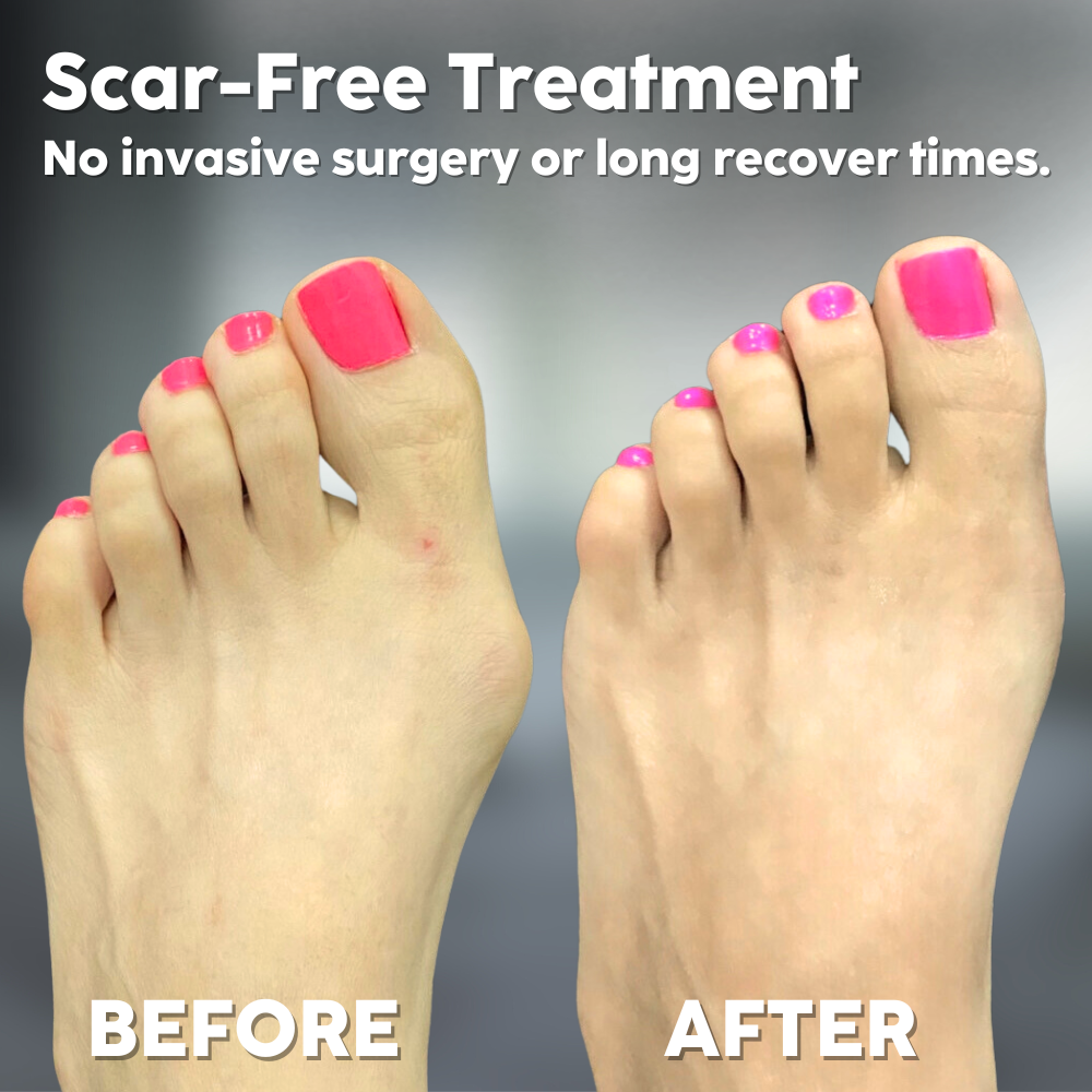 CurePain™ - Orthopädische Fußbehandlung