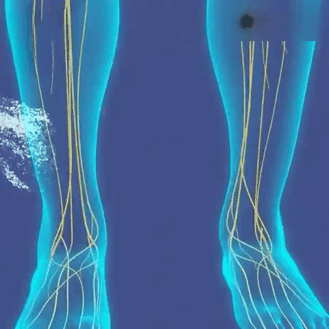 VitaliLeg™ Erleben Sie sofortige Linderung bei Gelenkschmerzen und Krampfadern! 1+1 GRATIS